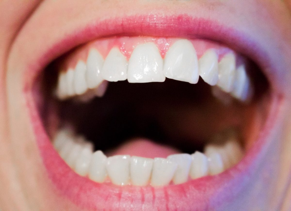 Obecna technika używana w salonach stomatologii estetycznej być może sprawić, że odzyskamy piękny uśmiech.